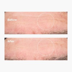 Hyaluronic acide 30ml